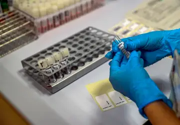 Estados Unidos confirmam primeiro caso de varíola do macaco em 2022